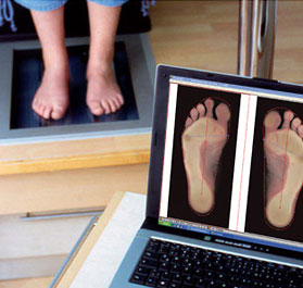 2D-Fußscan zur exakten Fußvermessung