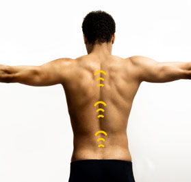 Rücken mit Gekennzeichnetem Verlauf der Wirbelsäule